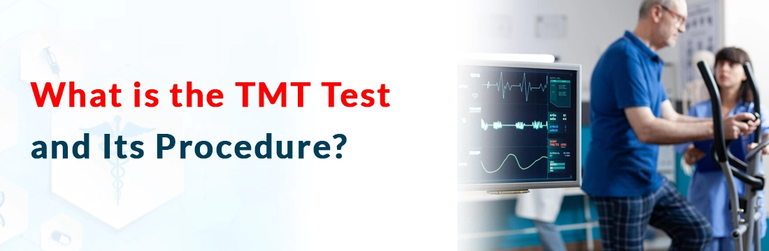  What is the TMT Test and Its Procedure?